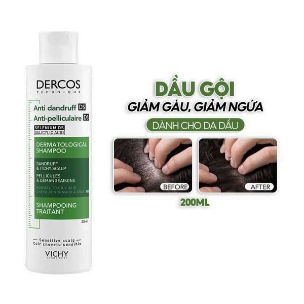 Dầu gội giảm gàu cho da đầu dầu ngứa Vichy Dercos Anti Dandruff DS Dermatological Shampoo 200ml