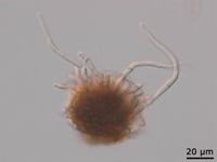 pseudocercospora-fijiensis-benh-dom-la-tren-cay-chuoi-sigatoka-den