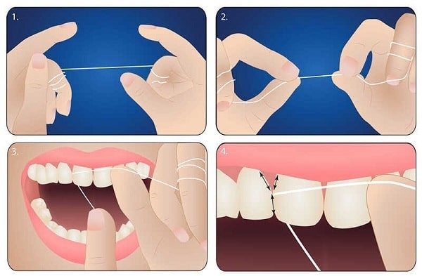 sai lầm trong dùng chỉ nha khoa vệ sinh răng miệng