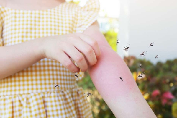 Mẹo trị muỗi đốt ở trẻ bằng phương pháp tự nhiên và cách phòng ngừa muỗi đốt ở trẻ