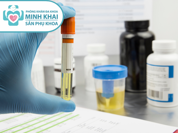 xét nghiệm tiền sản giật là gì