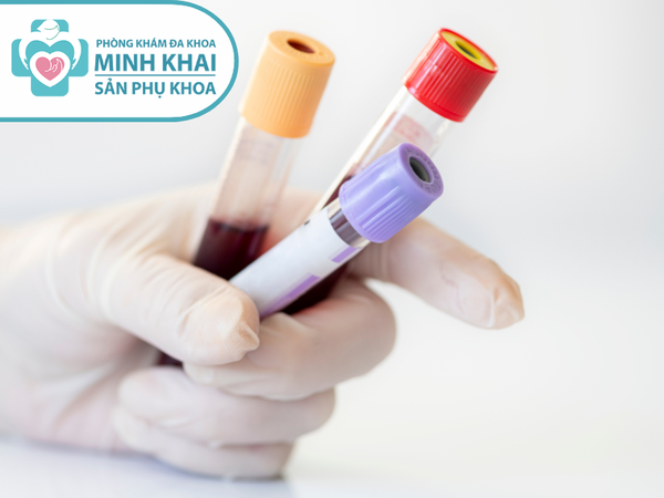 xét nghiệm sàng lọc tiền sản giật