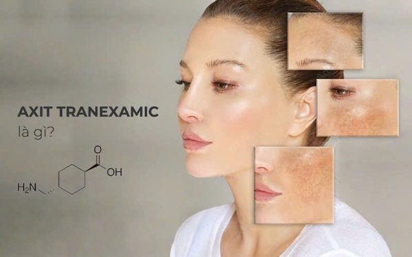 TRANEXAMIC LÀ GÌ? CÔNG DỤNG ĐỐI VỚI LÀN DA? TRANEXAMIC LÀ GÌ? CÔNG DỤNG ĐỐI VỚI LÀN DA?