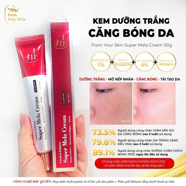Kem trị nám trắng da FYS Super Mela Cream 50gr