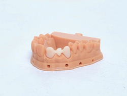 Nhựa resin cho phục hình tạm