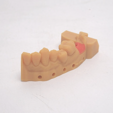 Nhựa Mô Nướu Nhân Tạo: Nhựa để tạo mô nướu nhân tạo