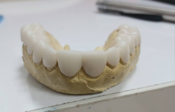 TẤM NHỰA ÉP hàm veneer dán. Đóng gói 10 tờ/túi, hình tròn đường kính 125mm, độ dày 1mm, màu A2