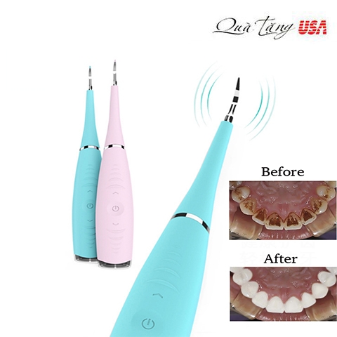 Dụng cụ lấy vôi răng và các vết ố trên răng Uniharpa Household Electric Dental Calculus Remover