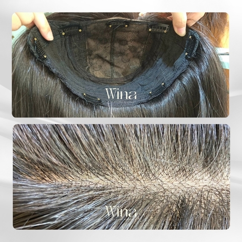 Tóc giả 3/4 đầu: Sự kết hợp giữa tóc mái hói và tóc giả nguyên đầu