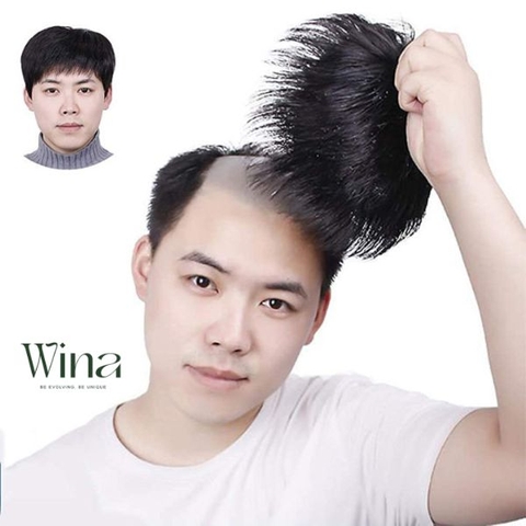 Khôi phục diện mạo nhanh chóng chỉ với tóc giả chất lượng tại Wina Wigs