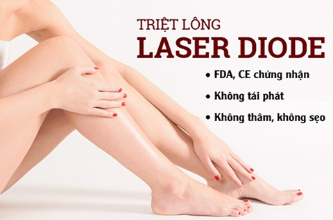 cong_nghe_triet_long_diode_laser