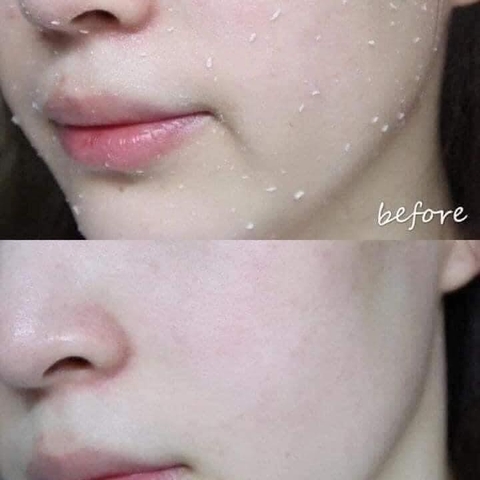 Tẩy Tế Bào Chết Dạng Gel Dịu Nhẹ CURE Natural Aqua Gel 250g