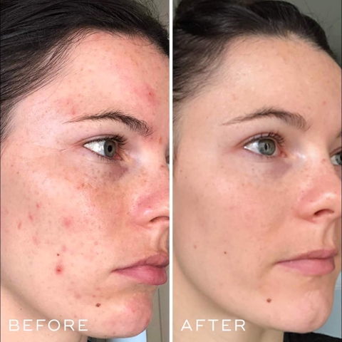 Serum phục hồi cấp ẩm Medik8 Hydr8 B5 Hydration 60ml