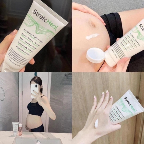 Kem bôi rạn da chuyên dụng StretcHeal 180ml Mỹ