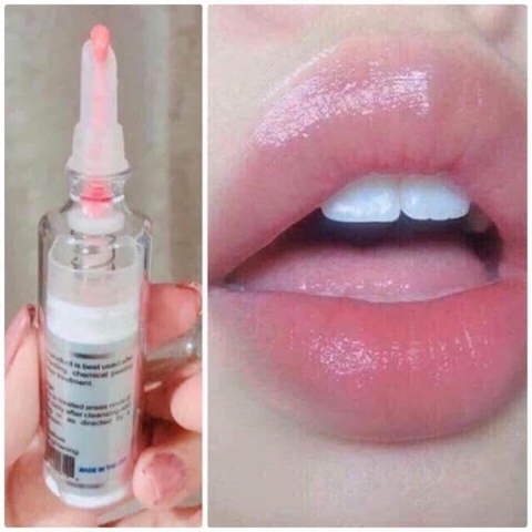 Kem Trị Thâm Môi Nuwhite L1A Mibiti Prudente của Mỹ