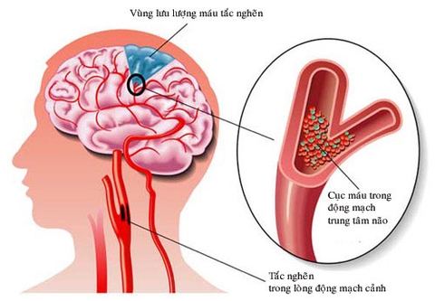 Thuốc bổ thần kinh TANAKAN 90 viên nén