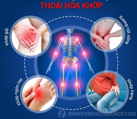 Viên bổ xương khớp Chondro-Aid fort tốt không