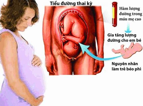 Dinh dưỡng trong bệnh đái tháo đường thai kỳ