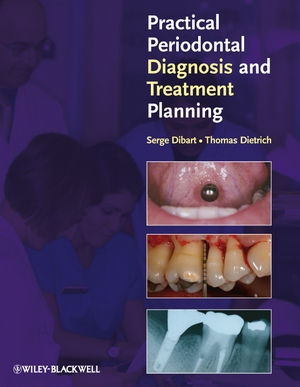 Practical Periodontal Diagnosis and Treatment Planning - Wiley-Blackwell_ 1 edition