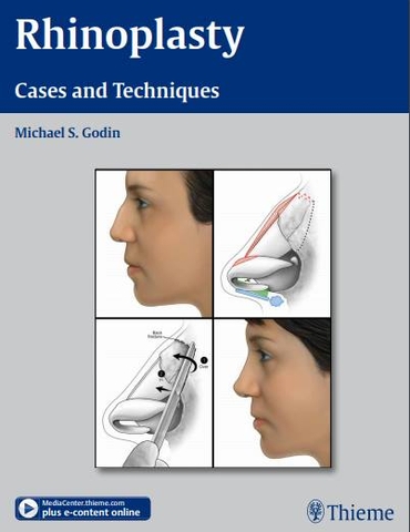Sách  rhinoplasty : Cases and Techniques
