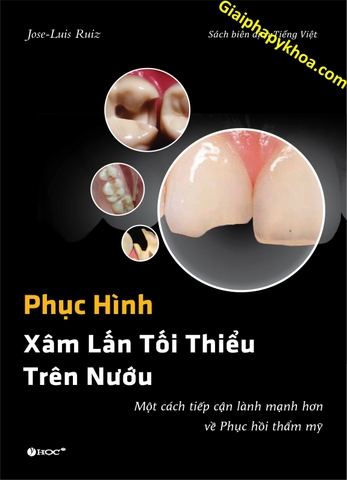 Sách Phục Hình Xâm Lấn Tối Thiểu Trên Nướu - Một cách tiếp cận lành mạnh hơn về Phục hồi thẩm mỹ