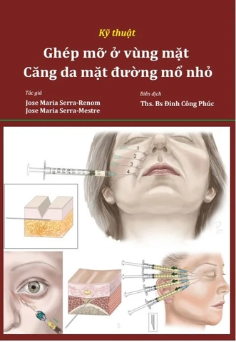 KỸ THUẬT GHÉP MỠ Ở VÙNG MẶT . CĂNG DA MẶT ĐƯỜNG MỔ NHỎ