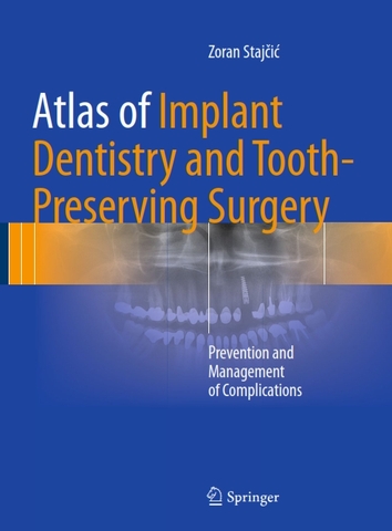 Sách Atlas Of Implant Dentistry And Tooth Preserving Surgery-Prevention And Management Of Complications  (2017)