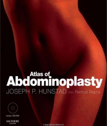 Sách atlas of Abdominoplasty (Techniques in Aesthetic Plastic Surgery)