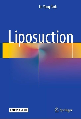 Sách liposuction 1st ed. 2018 edition