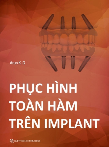 Sách phục hình toàn hàm trên implant