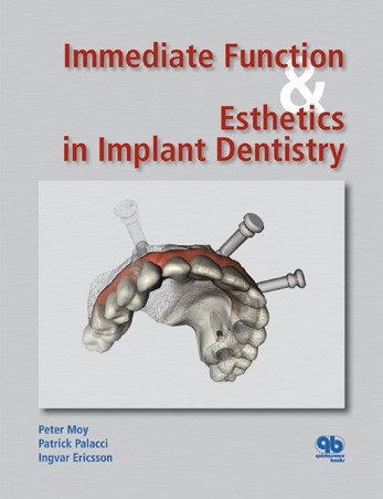 Immediate Function and Esthetics in Implant Dentistry - Quintessence Publishing_ 1 edition