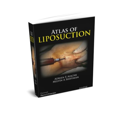 Sách Atlas of Liposuction
