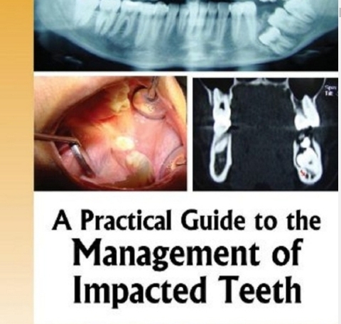 Sách A Practical Guide to the Management of Impacted Teeth - Jaypee Brothers_ 1 edition