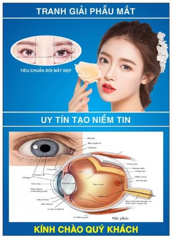 Tranh giải phẫu mắt - uy tín tạo niềm tin