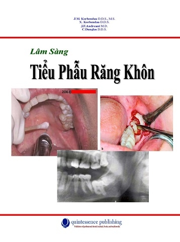 Sách Tiểu phẫu răng khôn.