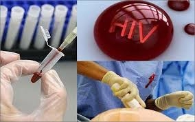 Các giai đoạn bệnh và chẩn đoán HIV/AIDS