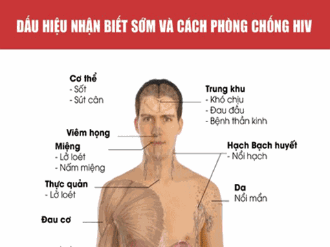 16 dấu hiệu khi nhiễm HIV dễ bỏ qua