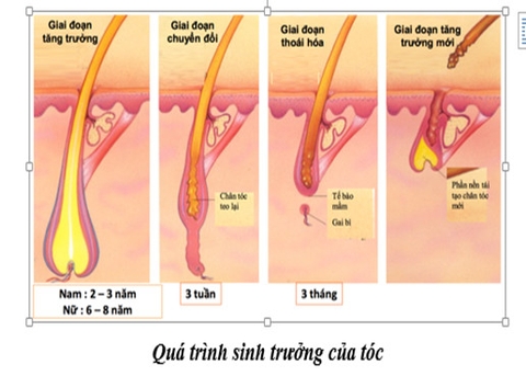 Điều trị rụng tóc hậu covid