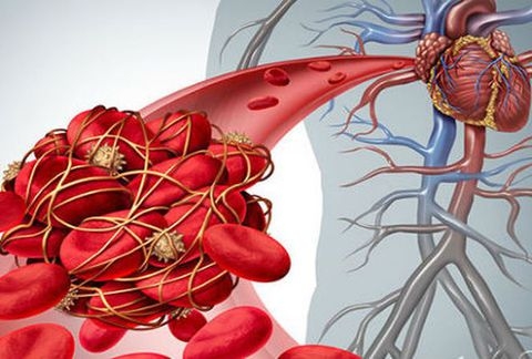 Xét nghiệm D-dimer ứng dụng trong lâm sàng