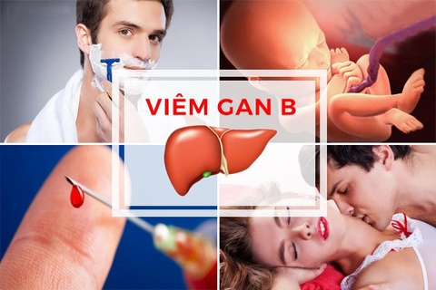 Con đường lây truyền của virus viêm gan B