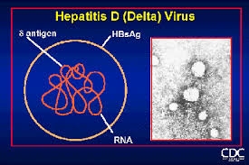 Bệnh viêm gan virus D