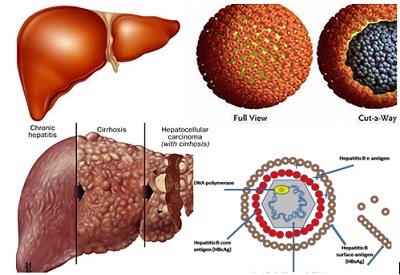Phân biệt các loại virus viêm gan gây bệnh