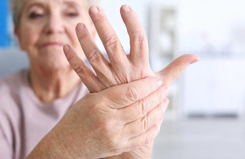 Viêm khớp dạng thấp có liên quan đến suy giảm nhận thức ở bệnh nhân sa sút trí tuệ