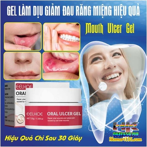 GEL LÀM DỊU GIẢM ĐAU RĂNG NHIỆT MIỆNG HIỆU QUẢ MOUTH ORAL ULCER 30GRAM