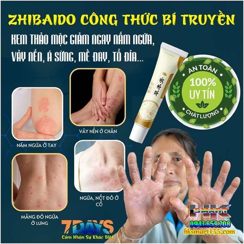 ZHIBAIDO CÔNG THỨC BÍ TRUYỀN- KEM THẢO MỘC BÔI GIẢM NGAY NẤM NGỨA, VẢY NẾN, Á SỪNG, MỀ ĐAY, TỔ ĐỈA...