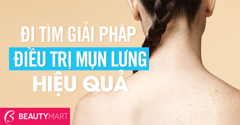 Điều trị mụn lưng và những điều bạn cần biết