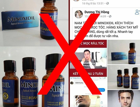 Minoxidil có hàng giả không ?