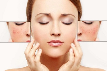 E năm nay 20 tuổi bị tàn nhang. Cho e hỏi công ty còn bán bộ trị nám tàn nhang, trắng hồng da collagen tây thi không?