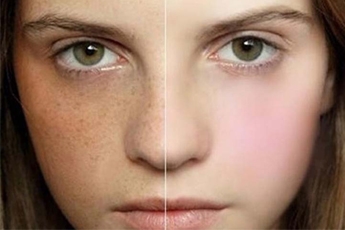 27 tuổi có dùng được bộ collagen tây thi không?