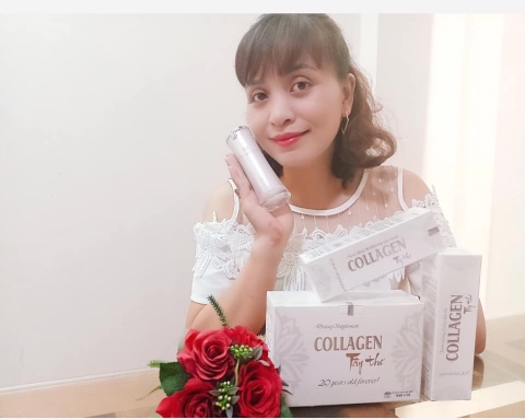 Mẹo Trị Nám Sau Sinh Của Bà Mẹ Một Con